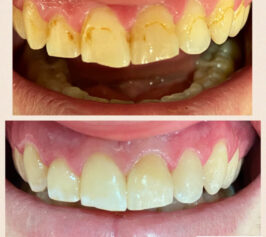 Tratamente 57 doctor claudia catana inainte dupa tratament 10